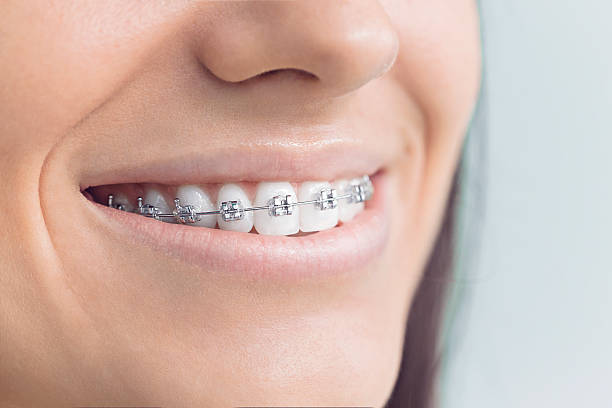 Best Dental Inlays and Onlays  in Ironton, OH